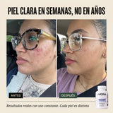 AVORA Skin — Suplemento con DIM | Piel Desde Adentro miniatura 4